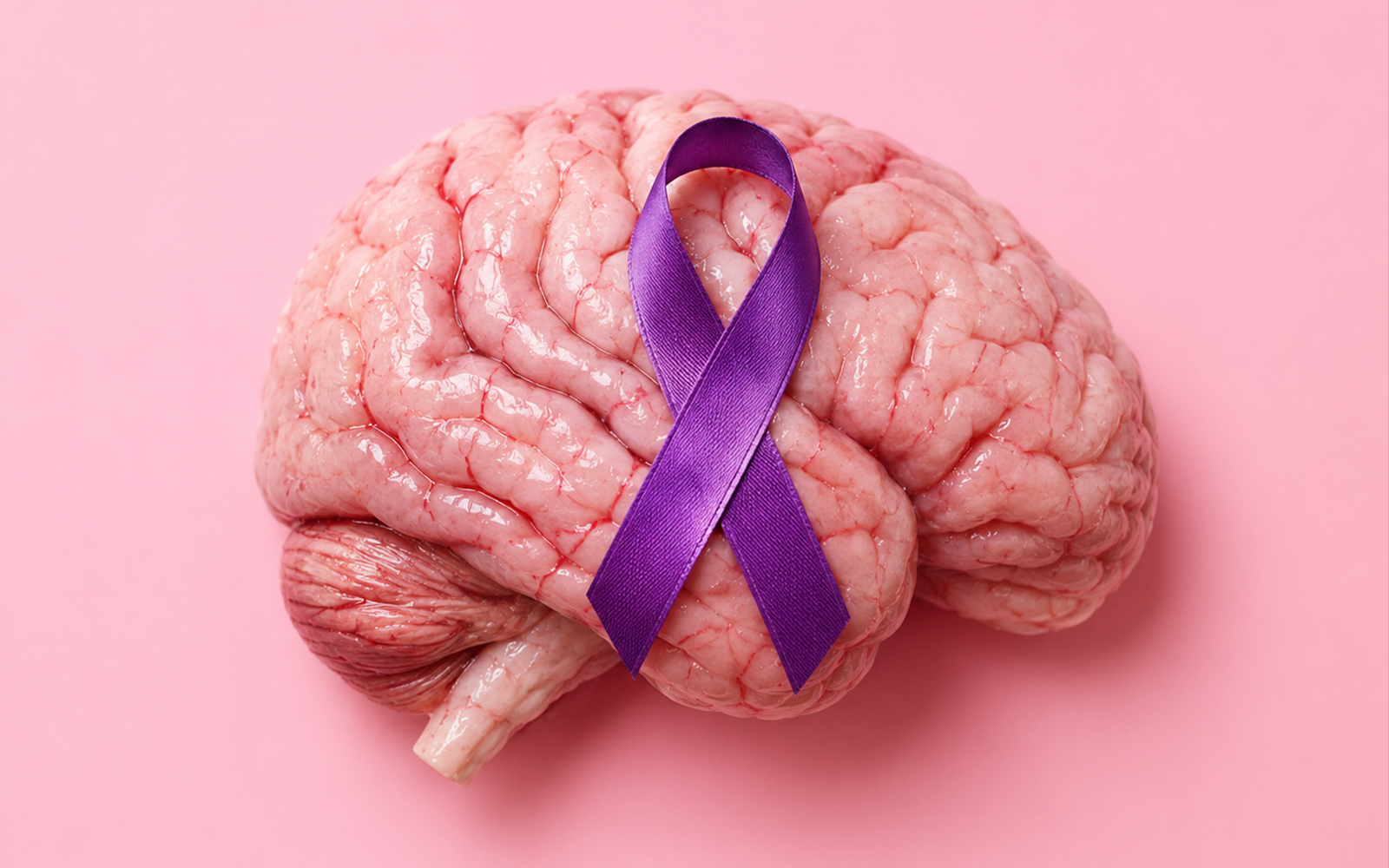 Collagen Radiation Tiles Offer New Hope for Patients With Brain Metastases