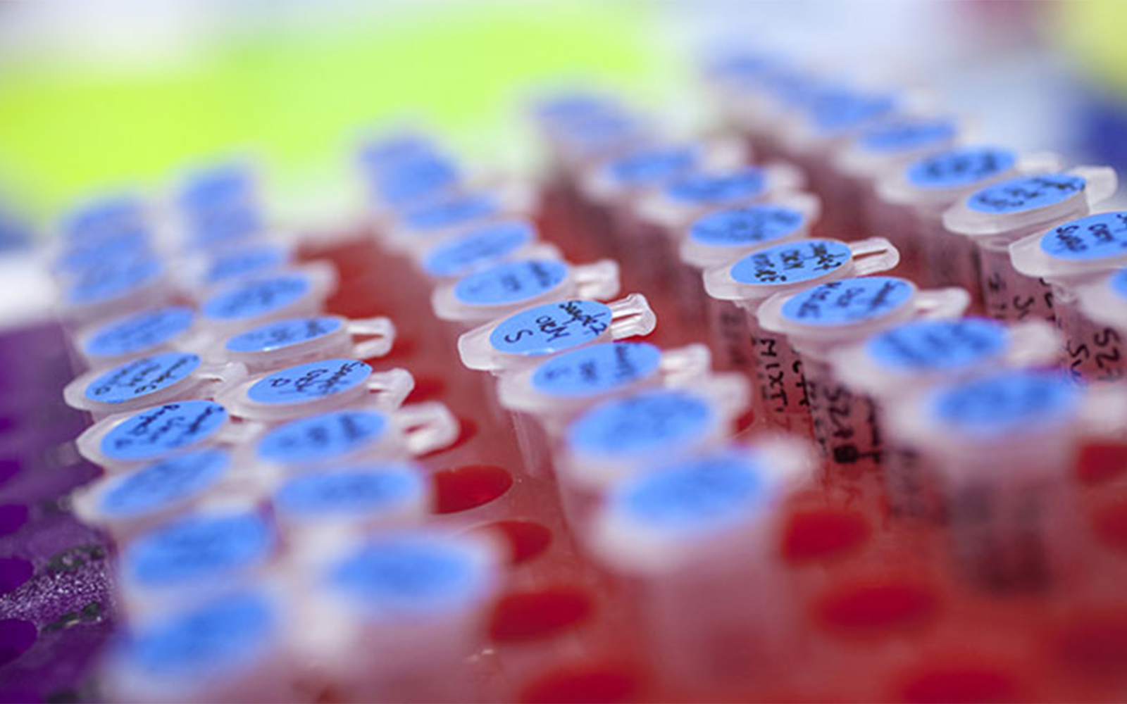 Global Collaboration Advances Precision Medicine for Inflammatory Bowel Disease