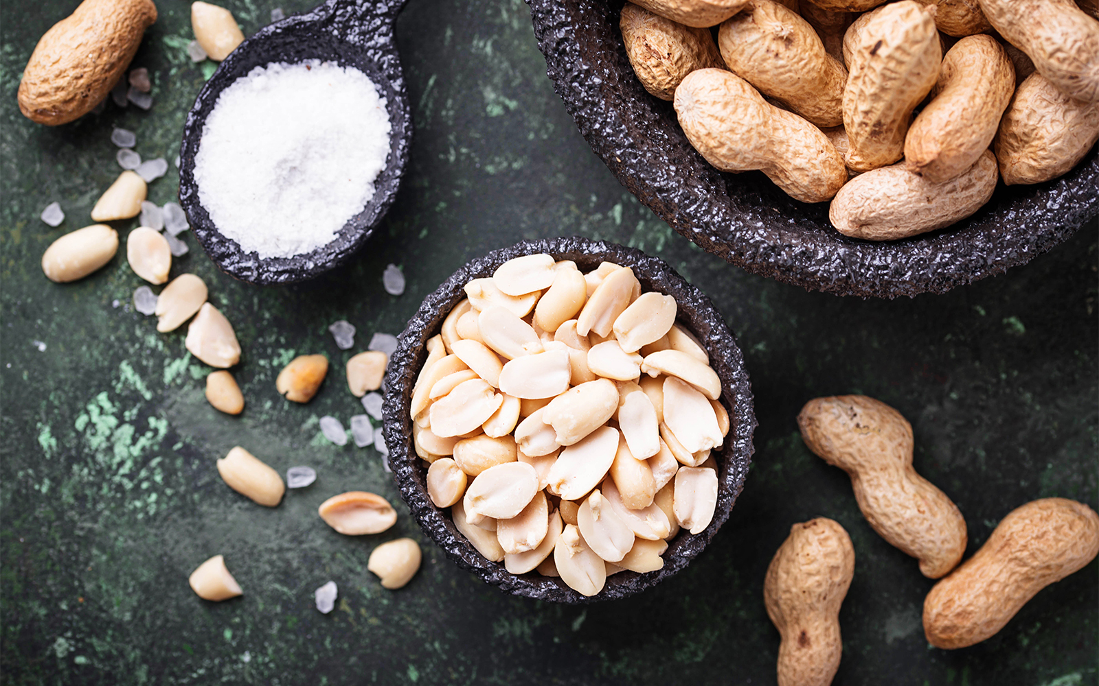 Gut Microbiome May Explain Differences in Peanut Allergy Reactions