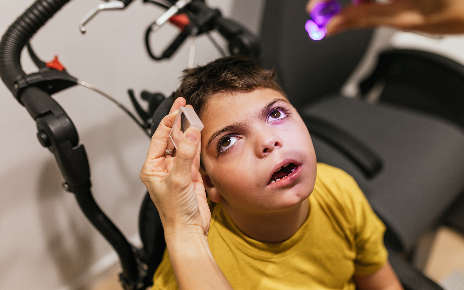 Rett Syndrome Study Finds Brain Changes Before Symptoms Begin