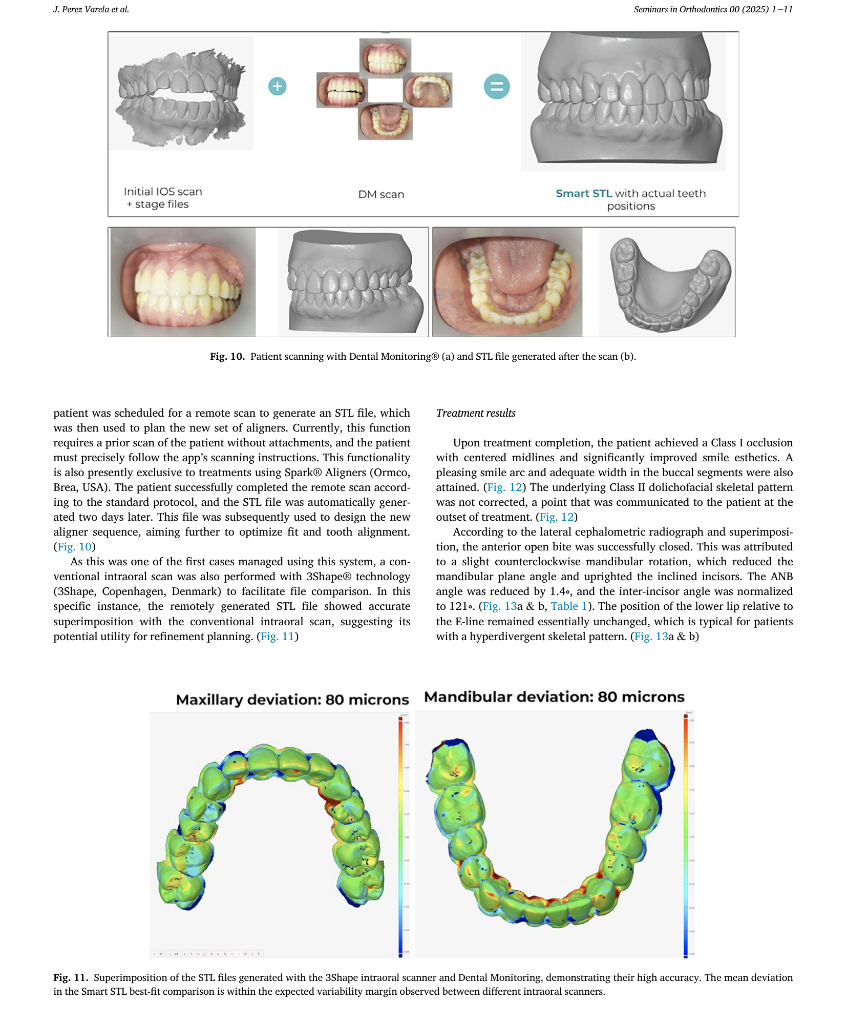 Case report page showing remote STL vs. conventional intraoral scan accuracy comparison